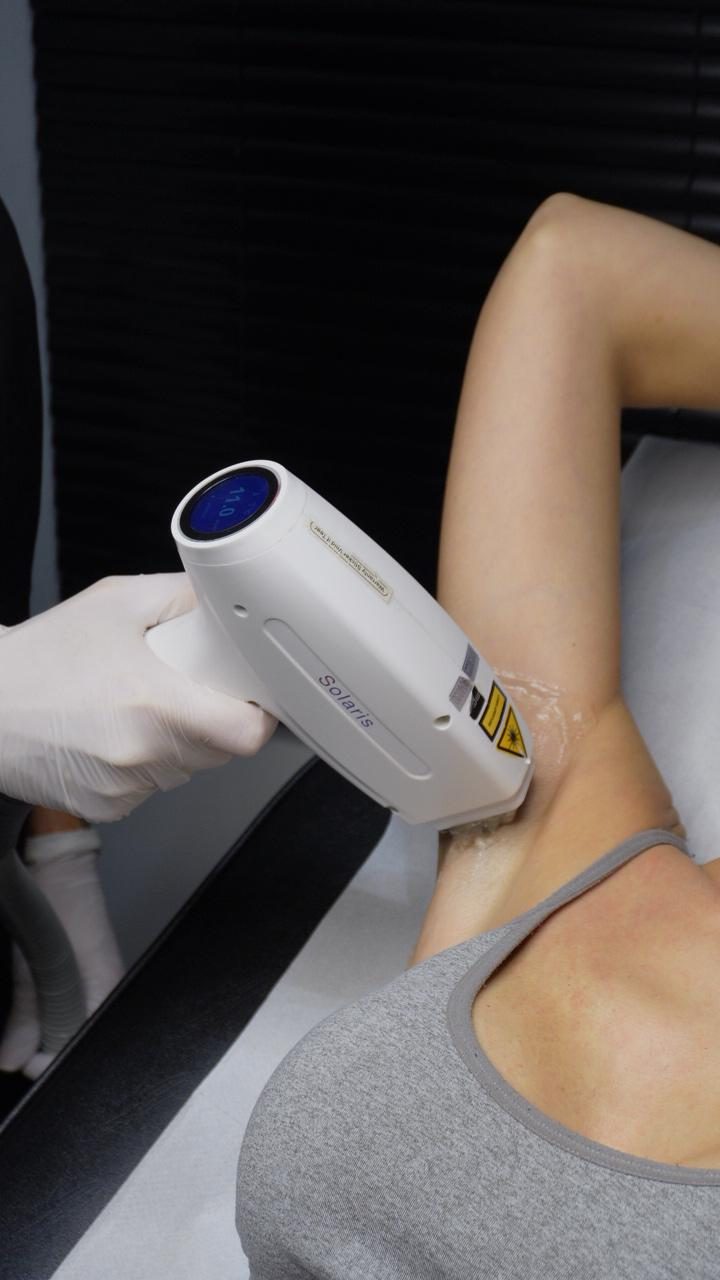 Laser treatment being performed at Surrey Laser & Skin Studio