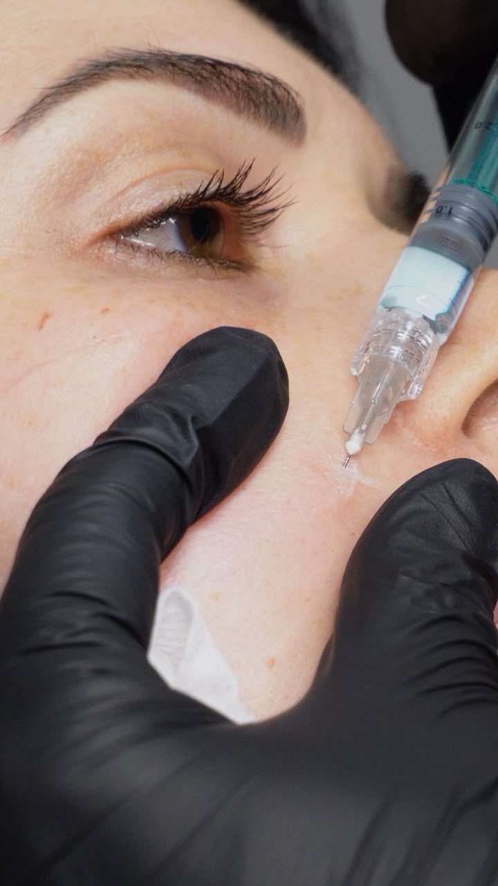 Skin rejuvenation treatment photo 3