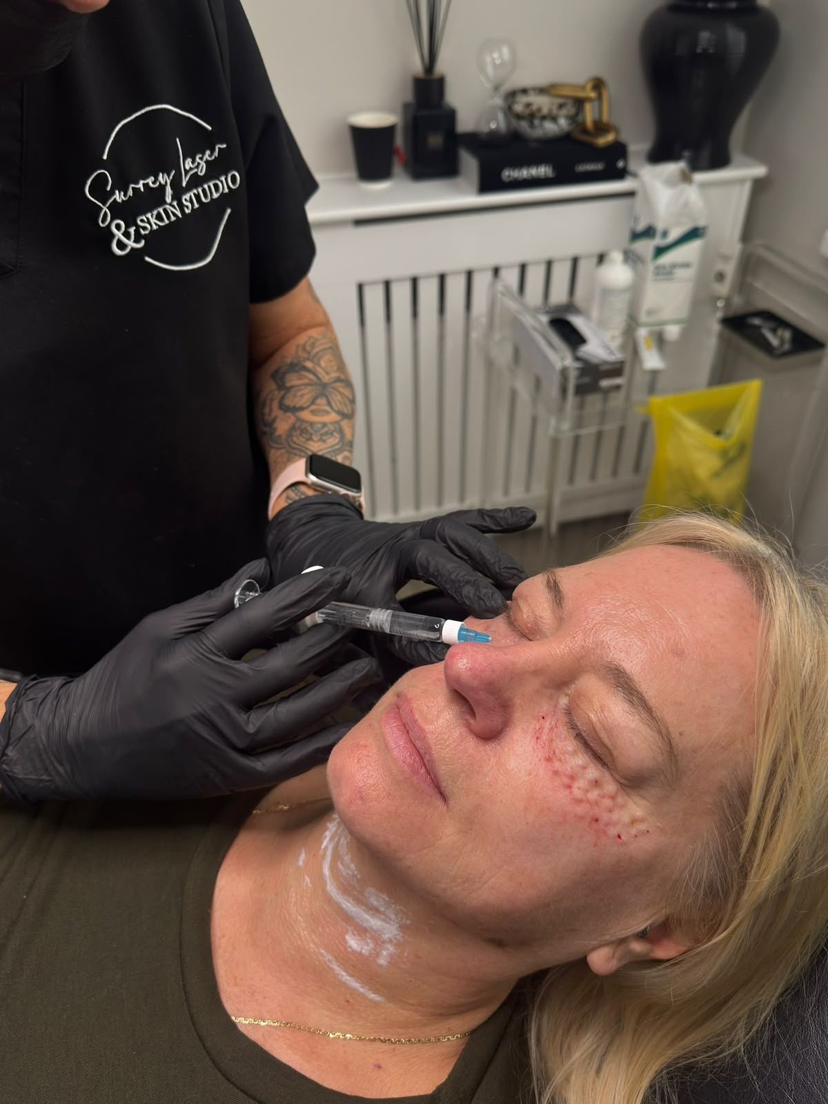 Skin rejuvenation treatment photo 5